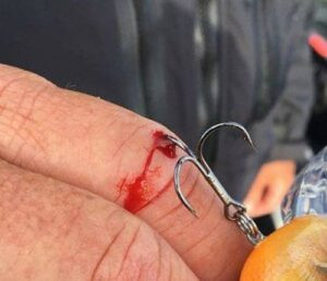 First Aid Tips for Fisherman