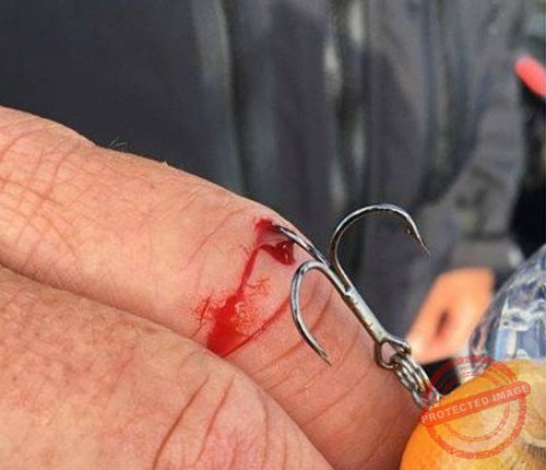 why you need a first aid kit